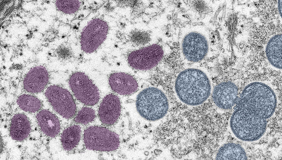 Coronavirus Resources